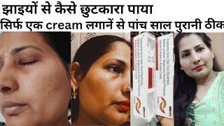 Cream For Pigmentation Pigmentation Removal Cream Skin Whitening Cream  झाइयां। [upl. by Dimitri]