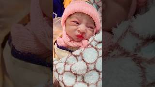 Newborn Baby with Cleft Lip only AfterBirth [upl. by Ardnasil837]