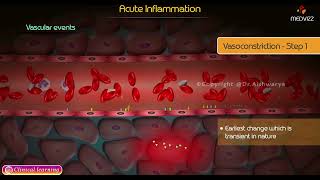 Acute Inflammation Animation  Pathology [upl. by Terra337]