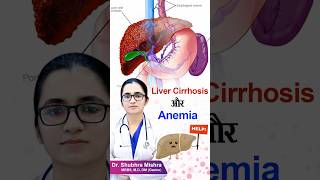 Liver cirrhosis or anemia shorts [upl. by Anwad]