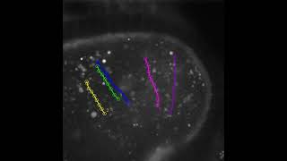 Cytoplasmic Streaming of Female Drosophila at Stage 11 Oogenesis Manual Particle Tracking SC [upl. by Alyad]