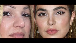 Instagram Model Negin Mirsalehi BEFORE plastic surgery real face [upl. by Gannes177]