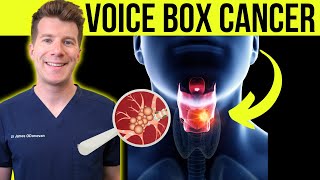 Doctor explains Laryngeal cancer voicebox cancer  Symptoms causes and treatment [upl. by Oznerol]