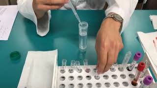 간접 항글로불린 검사Indirect Antiglobulin test [upl. by Japha391]