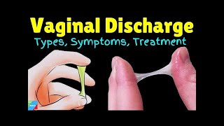 Vaginal Discharge  Is My Discharge Normal Thrush Bacterial Vaginosis STIFROM DR SIMI ADEDEJI [upl. by Hosfmann]