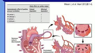 UNDERSTAND CARDIOPULMONARY INTERACT TO AVOID CLINICAL DISASTERS JD Chiche 2015 [upl. by Grubb]