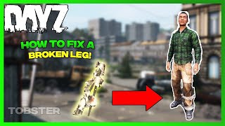 DayZ  How to Fix a Broken Leg Survival Guide [upl. by Lerrad]