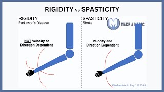 Rigidity vs Spasticity Explained [upl. by Ardeahp]