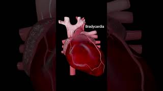 Heart anatomy heartattack heartbeat bradycardia 3danimation [upl. by Adi]