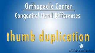 thumb duplication  congenital hand differences  Boston Childrens Hospital [upl. by Rahel]