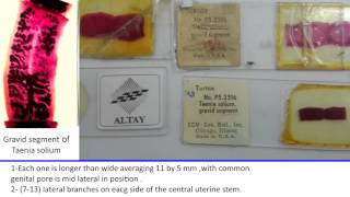 37 Practical Parasitology Grossly T Solium  T Saginata [upl. by Friedrick]