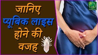 Pubic Lice  जानिए Pubic Lice होने की बजह  Treatment And Prevention  Lotus Ayurveda india [upl. by Dusen]