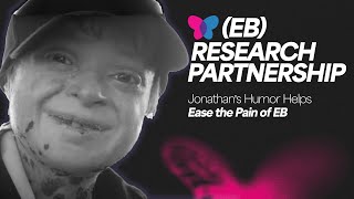 Jonathans Humor Helps Ease the Pain of EB  Venture Into Cures 2021 [upl. by Eimar]