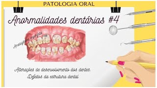 Anormalidades Dentárias  PARTE 4 [upl. by Tillfourd]