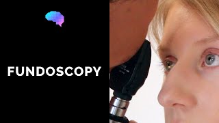 Fundoscopy Ophthalmoscopy  OSCE Guide  UKMLA  CPSA [upl. by Carina358]