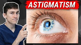 Astigmatism Explained  What You Need to Know [upl. by Leavelle534]