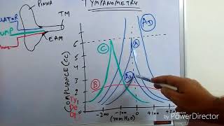 Tympanometry Impedance Audiometry [upl. by Meuser860]