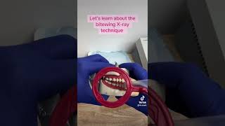 How to take bitewing Xrays dentalassistant dentalassistanteducation dentalhygienist dentist [upl. by Suirtemid]