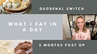 What I Eat In A Day 5 months after Duodenal Switch Surgery  Tina Lee DS [upl. by Nyrrek196]