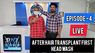 Episode 4 Live After Hair Transplant First Headwash  FUE Tamil Hair Transplant  Tamilan HT [upl. by Culbertson]