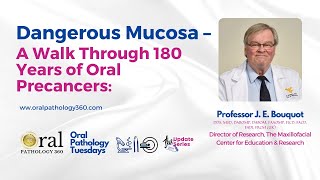 Dangerous Mucosa – A Walk Through 180 Years of Oral Precancers  Beyond Borders Oral Pathology360 [upl. by Innaig]