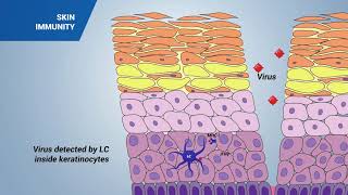 Immune response in the skin [upl. by Venetia]