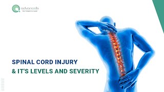 SpinalCordInjury  Spinal Cord Injury SCI amp Its Levels and Severity in Detail [upl. by Isis]