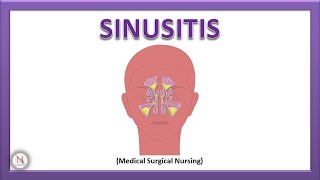 SINUSITIS  RHINOSINUSITIS  Acute amp Chronic Sinusitis  Pathophysiology  The Nurses Station [upl. by Gimpel736]