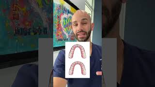 Invisalign to fix overcrowded upper teeth [upl. by Laura845]