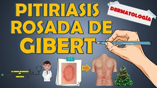 PITIRIASIS ROSADA DE GIBERT  GILBERT   ¿cuánto dura clínica tratamiento📝👨🏻‍⚕️EXPLICACIÓN FÁCIL [upl. by Memberg675]