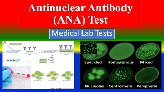 Antinuclear Antibody ANA Test   Medical Lab Tests  What is   Uses  Need  Results [upl. by Wendeline]