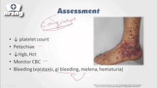 Thrombocytopenia NCLEX® Review  NRSNGacademycom [upl. by Yovonnda]