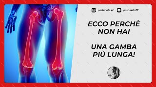 BACINO DISALLINEATO ECCO PERCHÈ NON HAI UNA GAMBA PIÙ LUNGA [upl. by Lengel515]