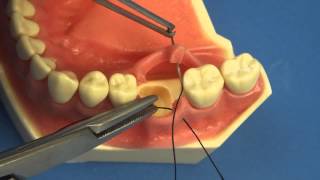 LEARN TO SUTURE THE EASY WAY  Surgical Technique  Interrupted Buccal Suturing  Dental  Medical [upl. by Alfons]