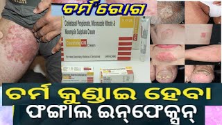 fungal infection treatment in odia  charma roga  clobeta gm cream in odia odiamedicaltip [upl. by Hagerman]