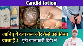 Candid lotion use dose benefits and side effects full review in hindi [upl. by Germayne]