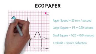 ECG BASIC WAVEFORMS [upl. by Suirred281]