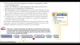 Learn With Me Diabetic Nephropathy Microalbuminuria Proteinuria [upl. by Oslec544]