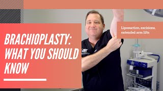 Brachioplasty arm lift things you should know [upl. by Decca728]