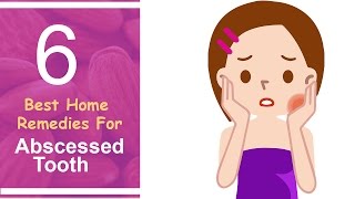 6 Best Home Remedies For Abscessed Tooth [upl. by Guthrie]