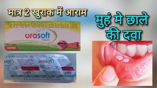 मुहं के छाले की टेबलेट Orasoft Mouth Ulcer tablet uses in hindi  ओरासोफ्ट टेबलेट [upl. by Etnaled]