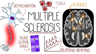 Understanding Multiple Sclerosis Multiple Sclerosis Explained [upl. by Kassaraba318]