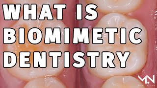 What is Biomimetic Dentistry Summary amp Benefits [upl. by Annekcm]