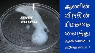 ஆணின் விந்தின் நிறத்தை வைத்து ஆண்மையை அறிவது எப்படி Tamil News [upl. by Analra700]