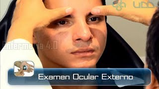 🌟EXAMEN OCULAR EXTERNO🌟 [upl. by Guilbert]