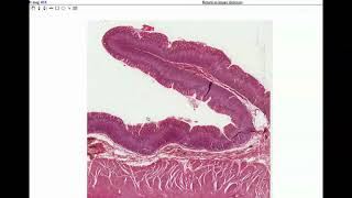 Anatomy  Histology of the Stomach amp Small Intestine [upl. by Iveel]