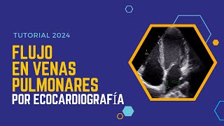 ✅FLUJO en VENAS PULMONARES por ECOCARDIOGRAFÍA 🔊Guía Completa con Doppler [upl. by Ardnasil]