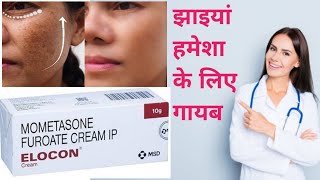 Elocon Cream Benefits  दाग धब्बे मिटाने की सबसे असरदार क्रीम  elocon cream review in hindi [upl. by Meyer]