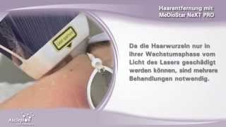 Haarentfernung mit dem Diodenlaser MeDioStar NeXT PRO von Asclepion [upl. by Oruasi]