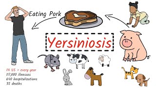 Yersiniosis  Yersiniosis  Causes Symptom Pathogenesis Diagnosis Treatment [upl. by Connelley392]